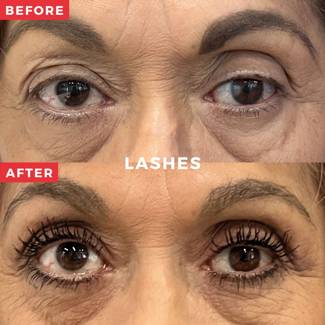 Suero de Pestañas y Cejas para 8 Meses