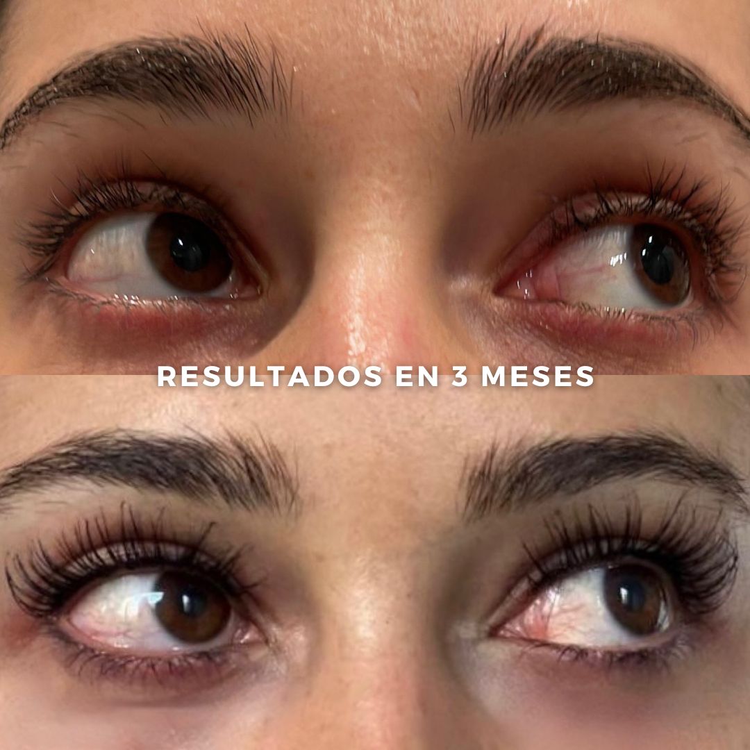 Paquete de 5 Sueros para pestañas y cejas