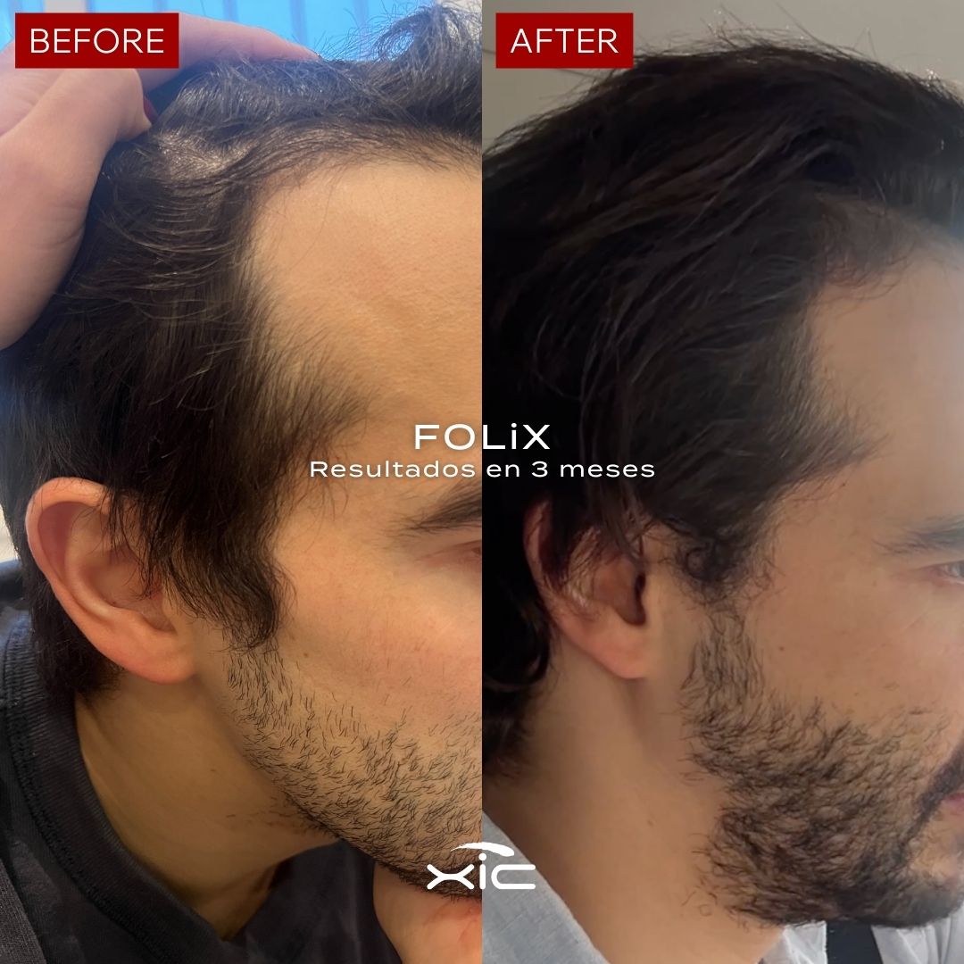 FOLiX Suplemento Alimenticio con Biotina y Colágeno