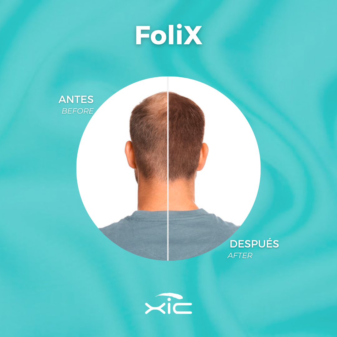 FOLiX