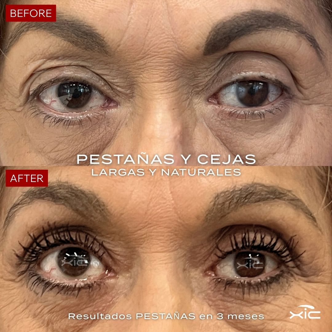 Trio XiC + Cosmetiquera