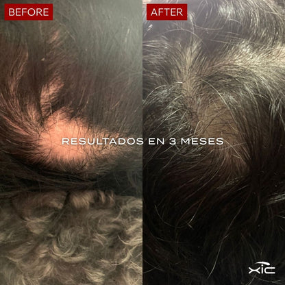 3 FOLiX - Suplemento para el Crecimiento del Cabello