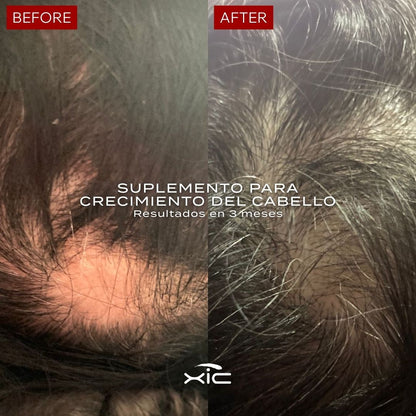 3 FOLiX - Suplemento para el Crecimiento del Cabello