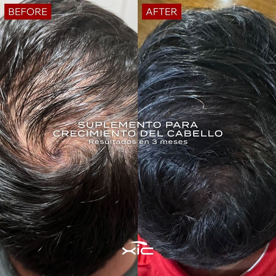 FOLiX Suplemento para el Crecimiento del Cabello