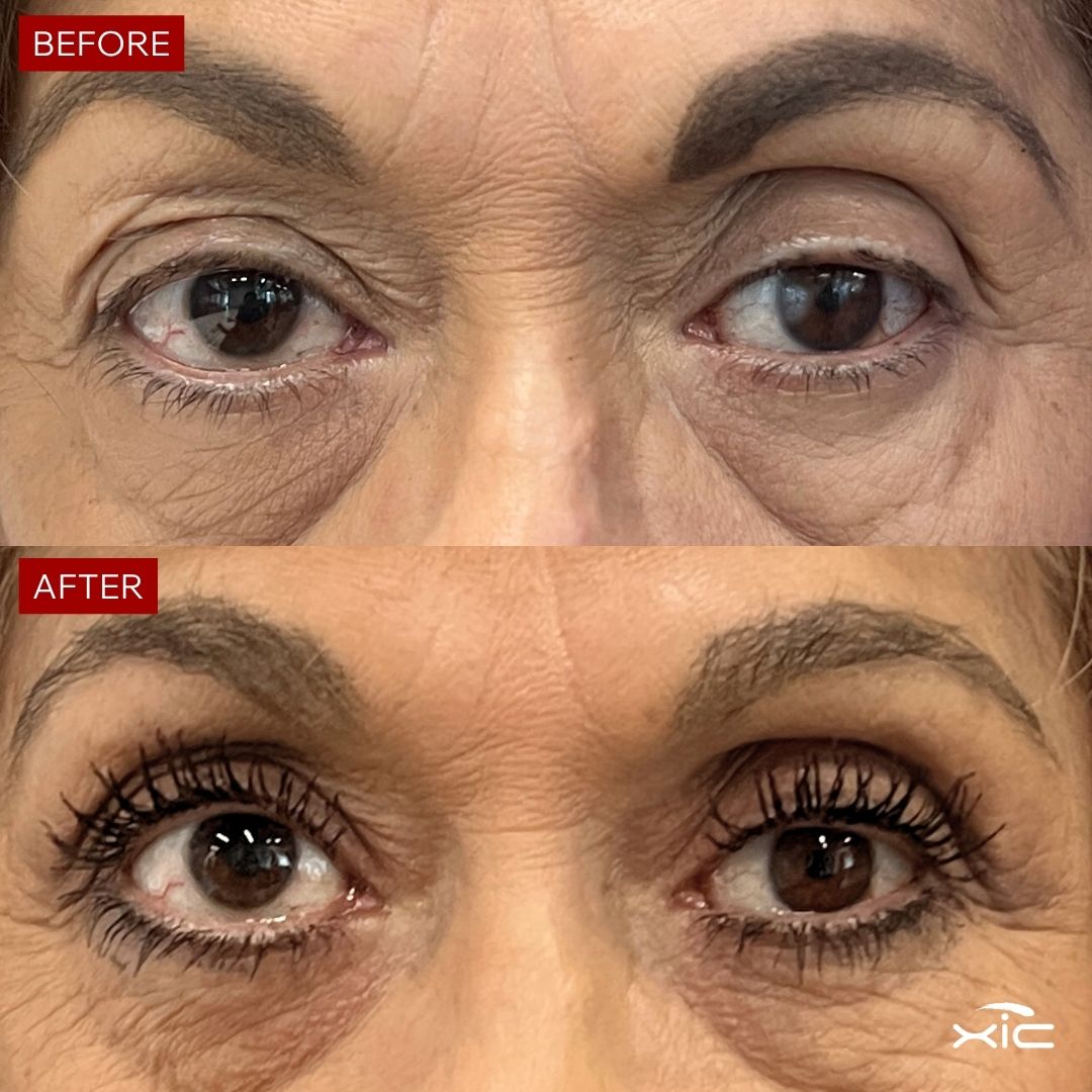Mini Suero Pestañas y Cejas para 3 Meses