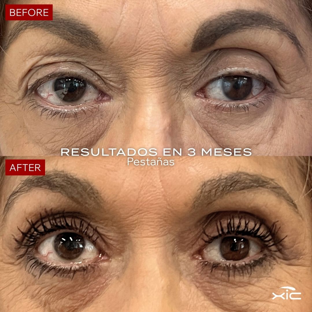 Suero de Pestañas y Cejas para 8 Meses